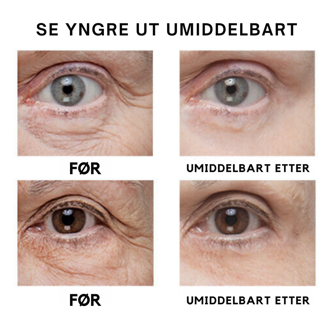 Øyeblikkelig midlertidig ansiktsstrammer (Bestselger)